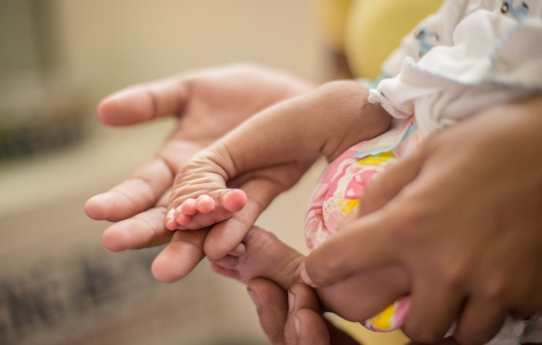 Eine Hand eines Erwachsenen hält einen Fuss eines Kindes, das einen Klumpfuss hat.